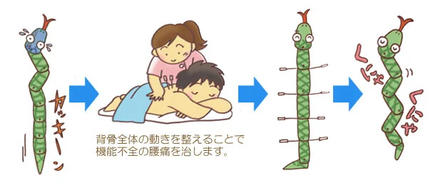 原因不明の腰痛の針治療