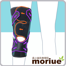 《スポーツ用》膝蓋骨外側脱臼【マクレスト】膝蓋骨が外側に脱臼するのを予防する膝サポーターです。