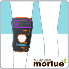 《スポーツ用》膝蓋軟骨軟化症【エクスエイドアクティブ】膝蓋骨を安定させることで膝蓋軟骨を守る動きやすい医療用の膝サポーターです。