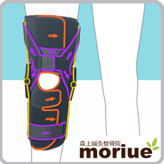 《スポーツ用》離断性骨軟骨炎【エクスエイドニーPCL】離断性骨軟骨炎にお勧めの膝サポーターです。