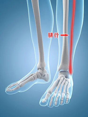 腓骨神経麻痺の鍼治療