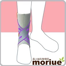 リウマチ性足部障害の治療に使える足首サポーター アンクルライト