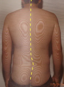 慢性前立腺炎|体全体の関節で負担のかかっている場所を調べます。