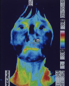 網膜色素変性症の検査サーモグラフィー画像