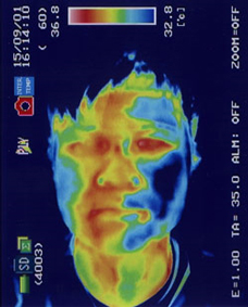 角膜のストレスの状態を調べるサーモグラフィー検査