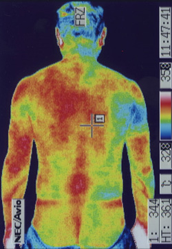 幻肢痛 | 体全体の温度分布を確認します。
